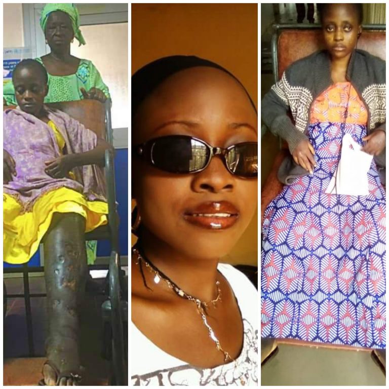Why I Attempted Suicide Three Times –Sickle Cell Patient