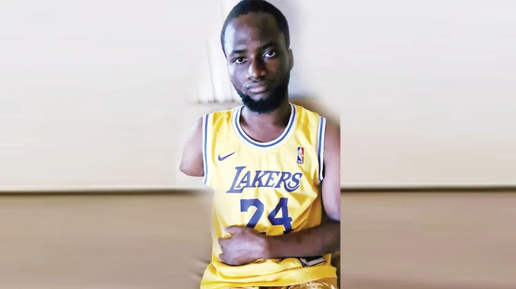 Factory worker loses hand due to industrial accident in Ikorodu