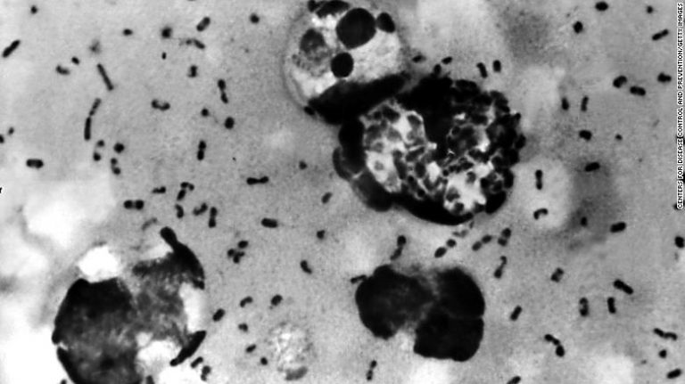 Bubonic Plague Reported In America Amid COVID-19 Pandemic