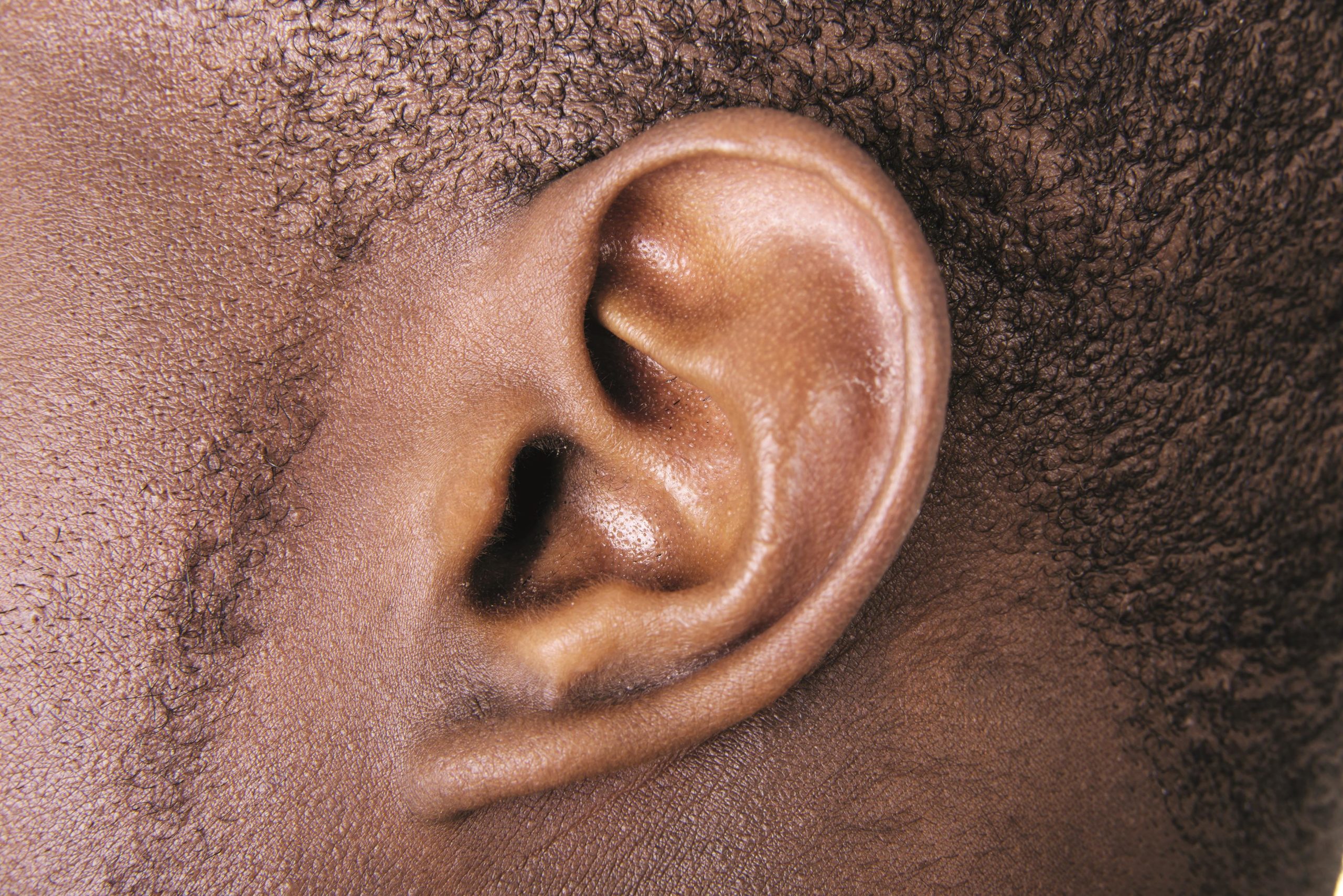 Hearing loss
