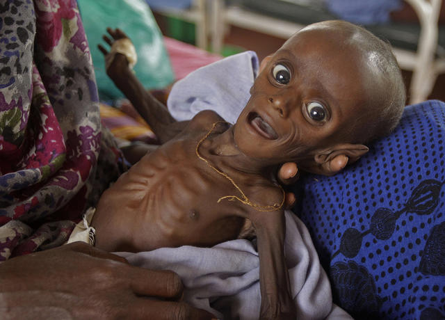 UN issues warnings about severe malnutrition in Nigeria and 14 other nations