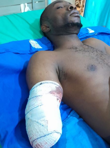 Factory Employee Suffers Forearm Amputation In Ogun: A Spotlight on Work Safety 
